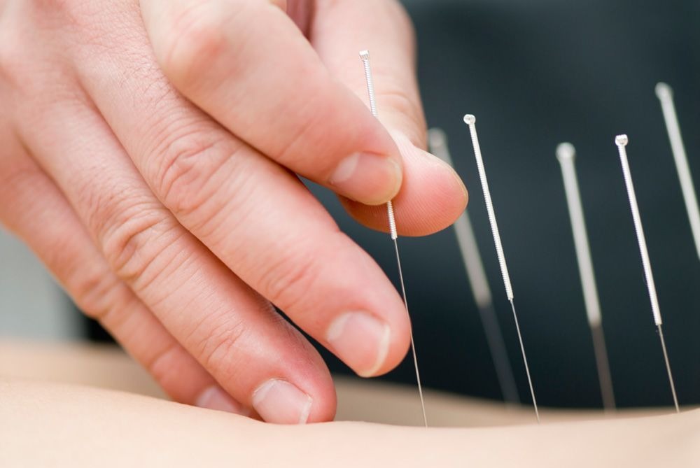 best fertility acupuncture NYC
