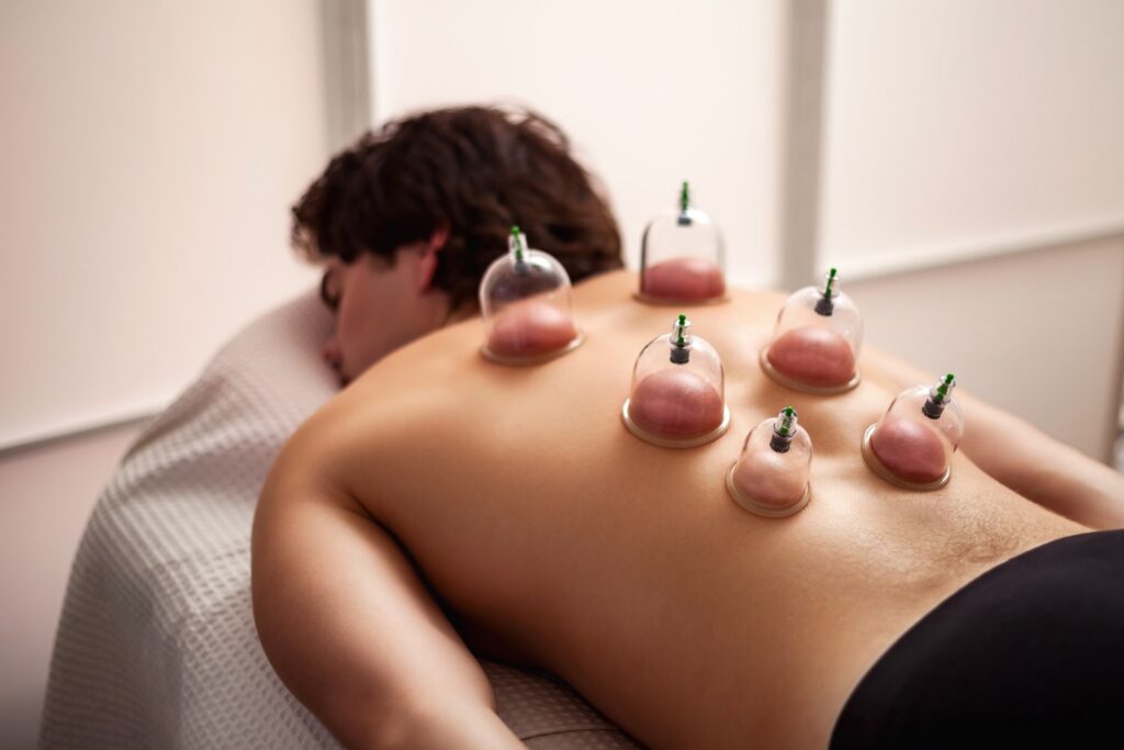 cupping therapy NYC
