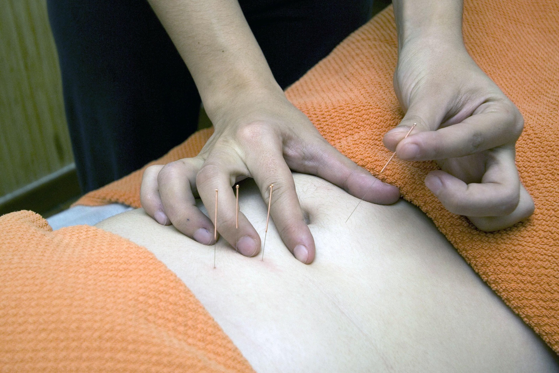 , Modern Acupuncture: How NYC Clinics Blend Tradition and Innovation