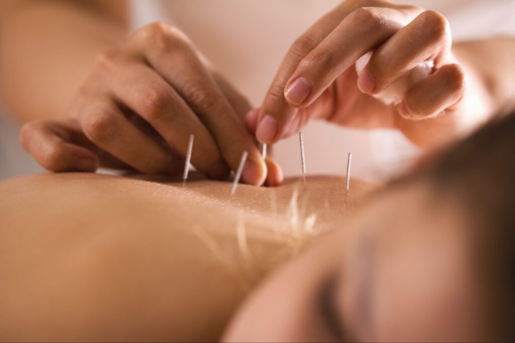 midtown acupuncture