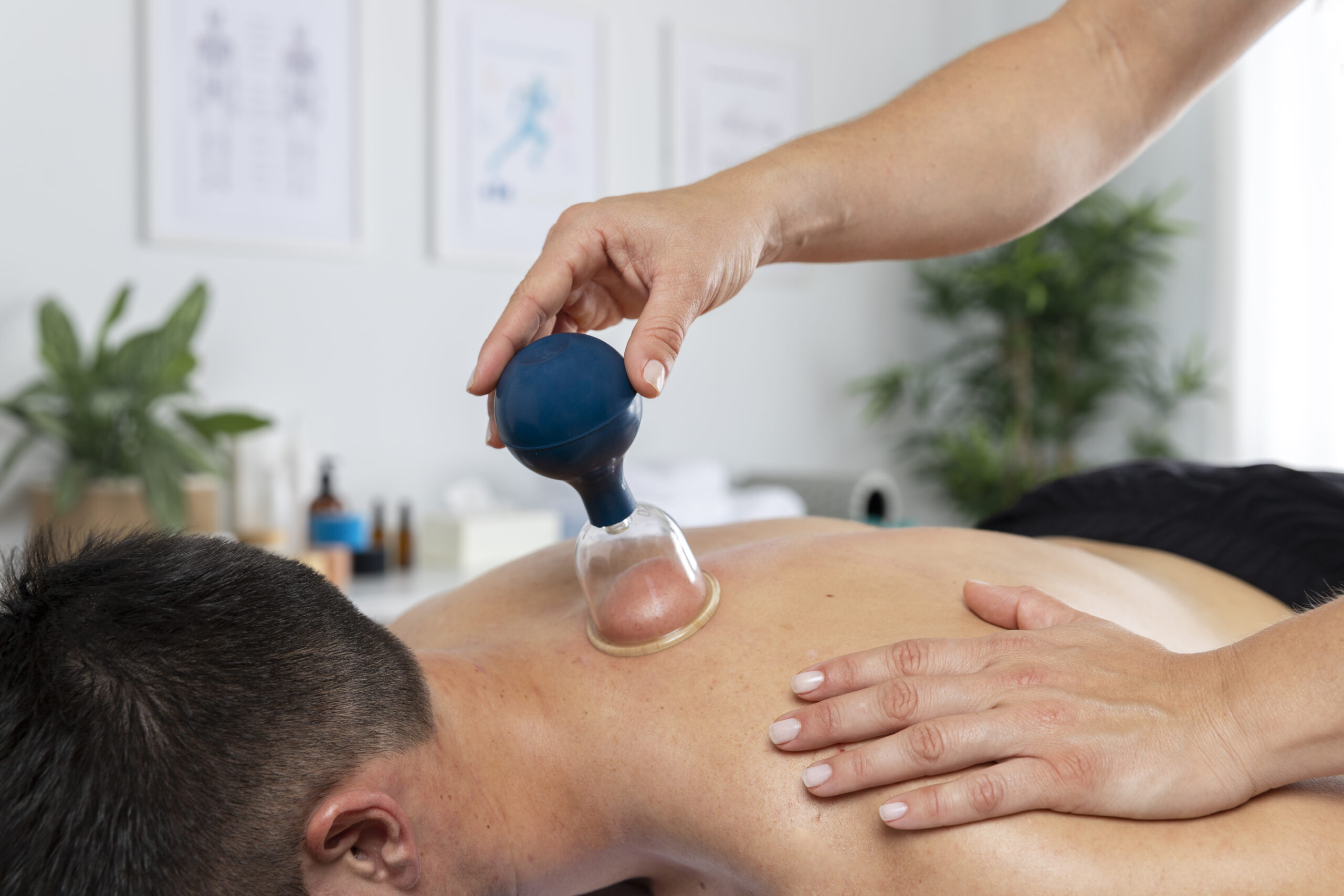 cupping therapy NYC, Muscle Recovery Secrets: How an Ancient Method Can Improve Modern Wellness