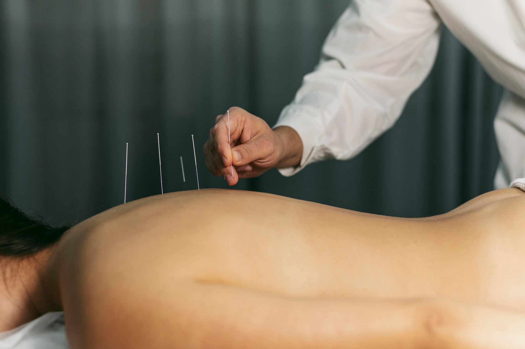 acupuncture NYC, Fertility, Focus, and Balance: Why More New Yorkers Are Turning to Acupuncture
