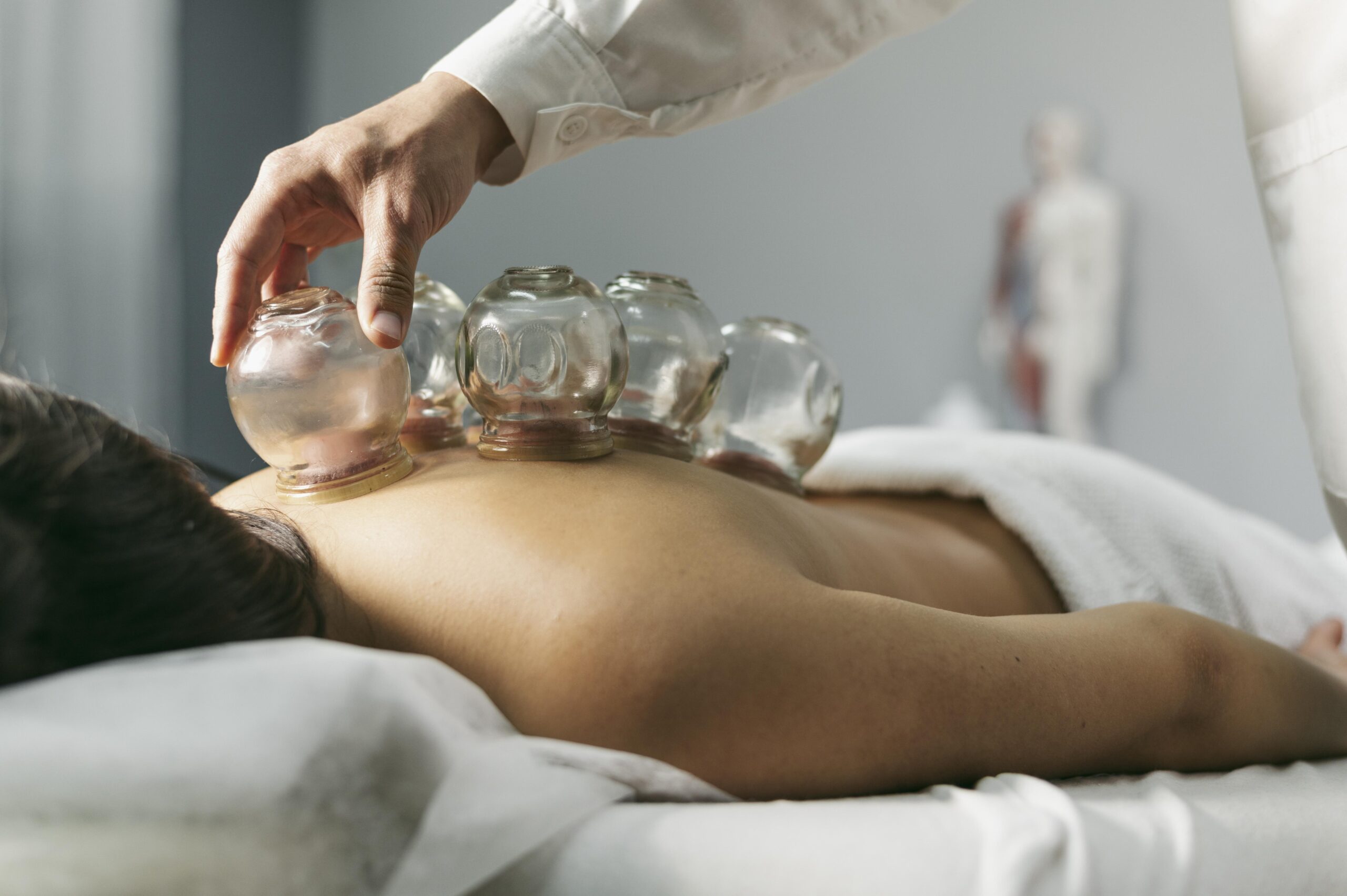 cupping therapy NYC, Cupping for Recovery and Relaxation in NYC