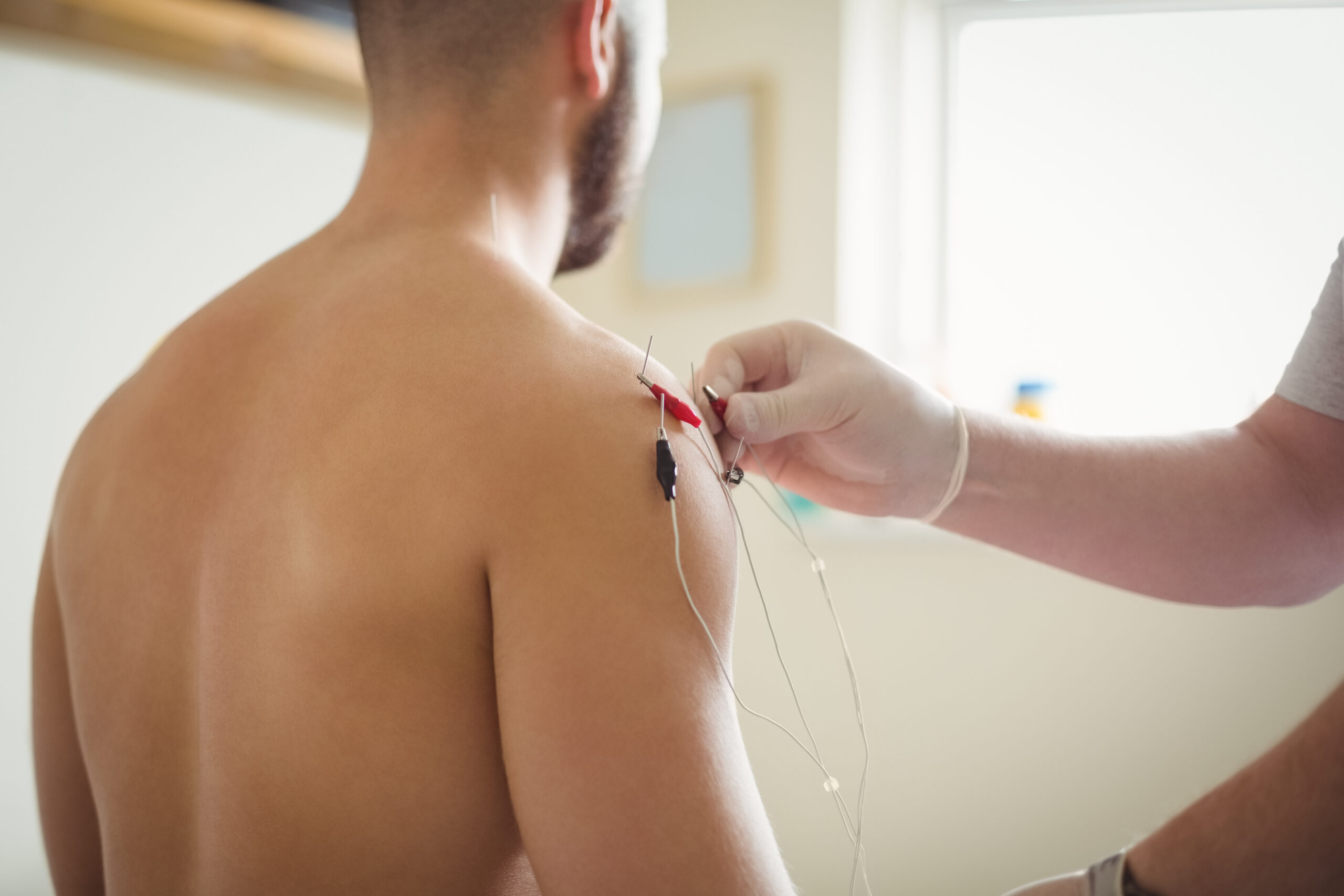 Acupuncture Bryant Park, How Acupuncture Can Support Healing After Injury or Surgery