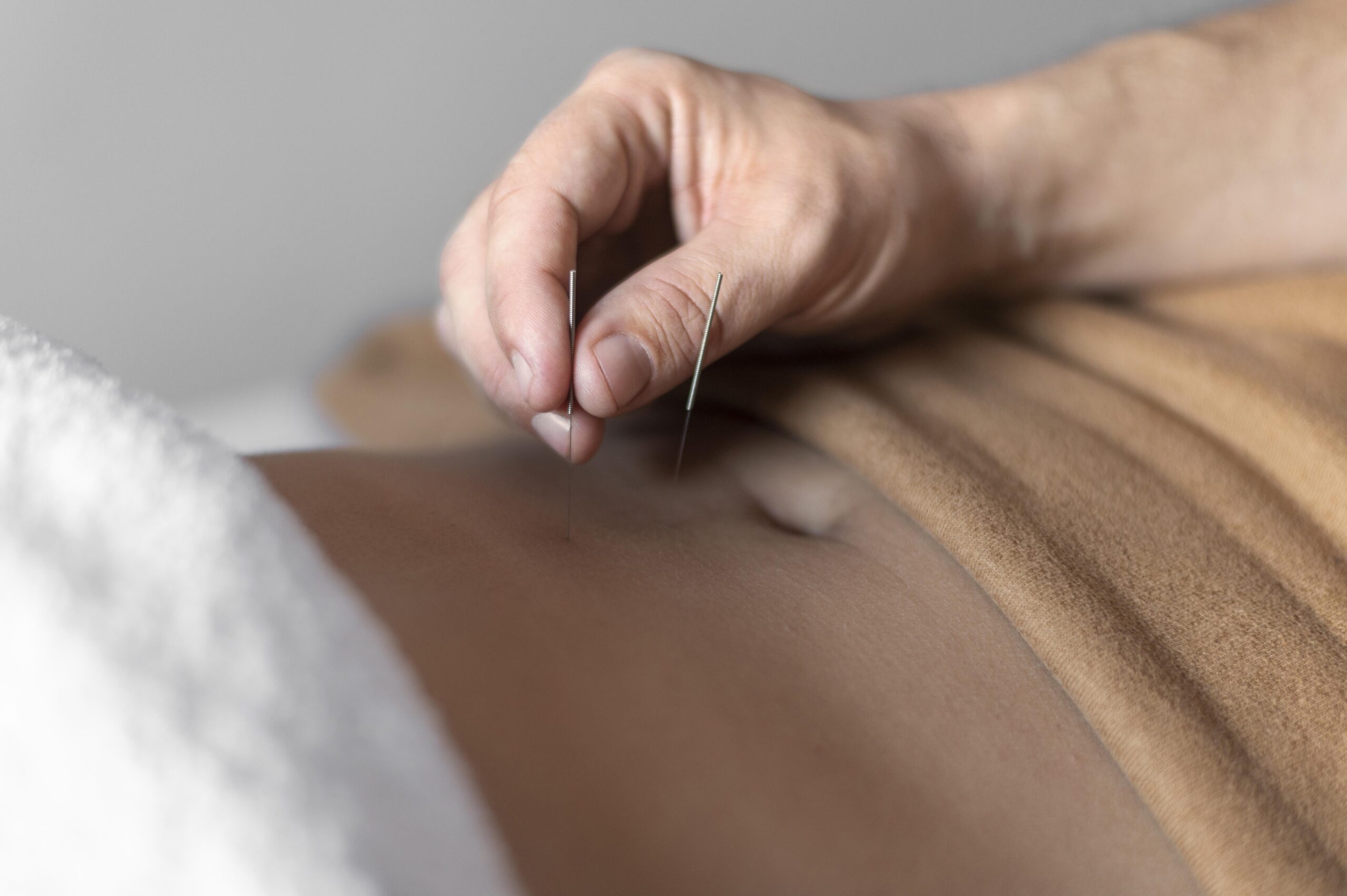 Top Fertility Acupuncture NYC, When to Start Acupuncture If You’re Planning to Conceive in the Next Year