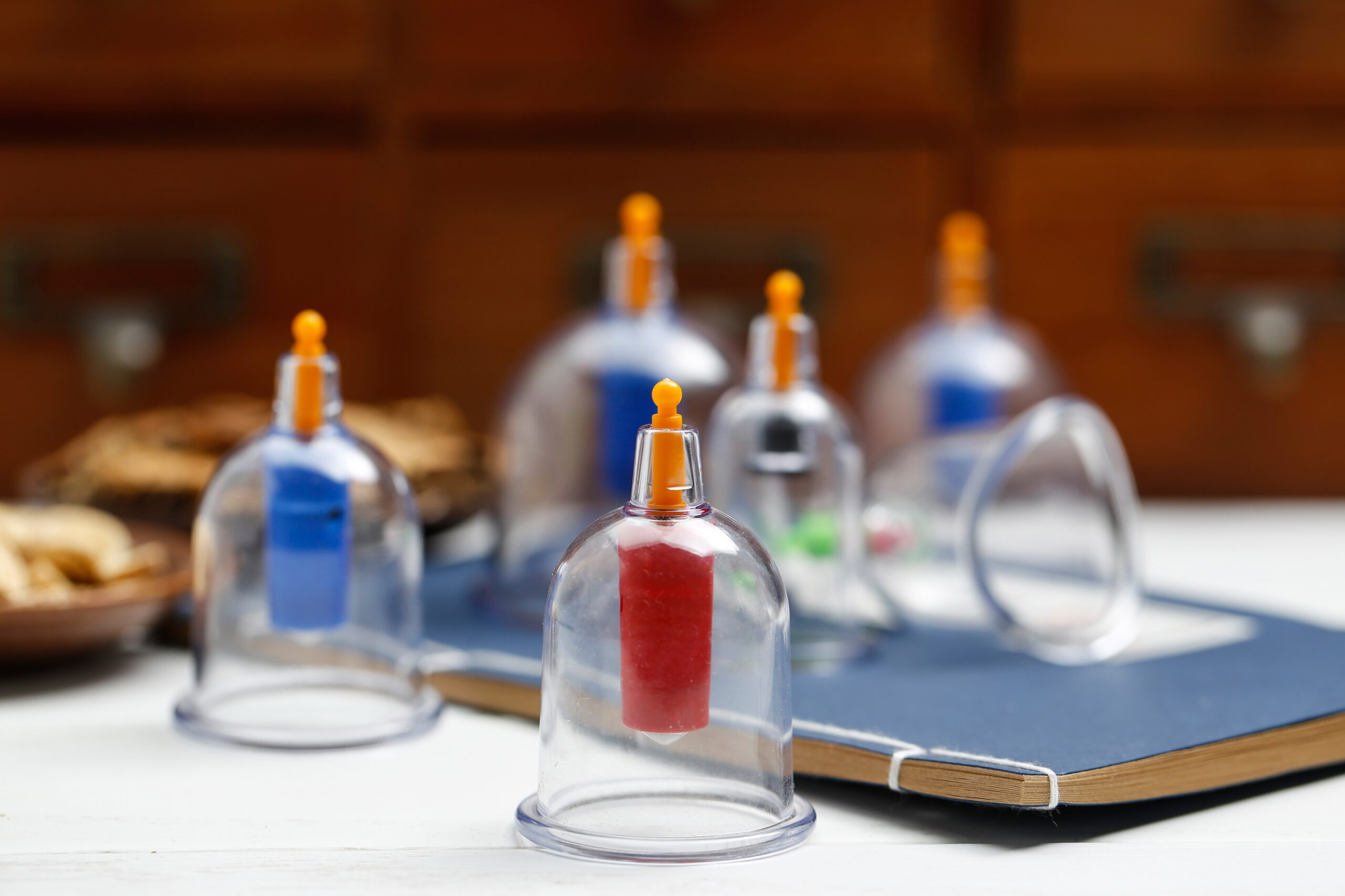 Dry Needling vs. Acupuncture NYC, Your First Cupping in NYC Session: What to Know Before You Book